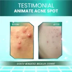 Obat Totol Jerawat Ampuh Acne Spot 10ml