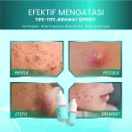 Obat Totol Jerawat Ampuh Acne Spot 10ml